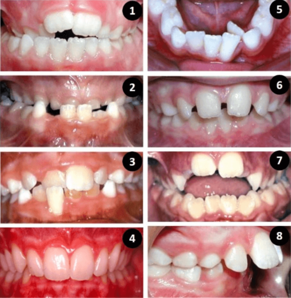 Orthodontie pour les enfants