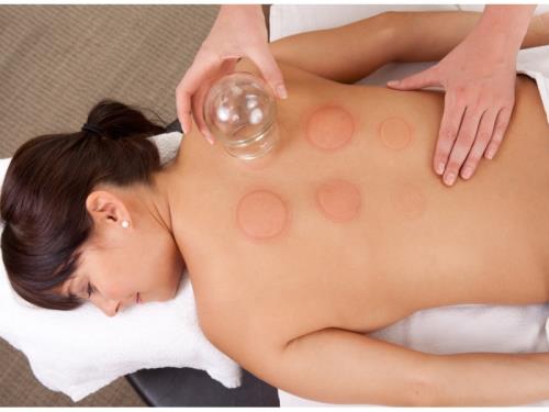 Cupping