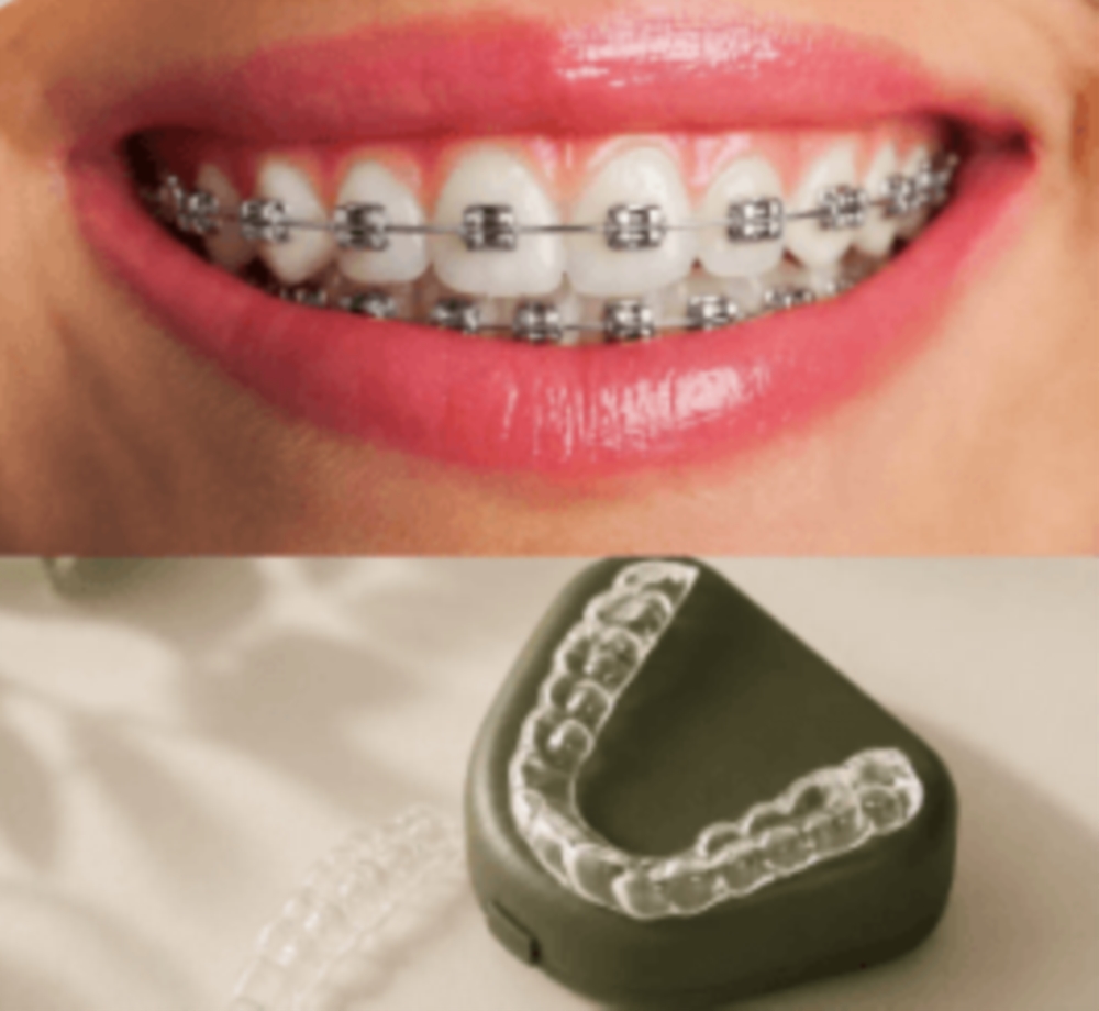 Orthodontie