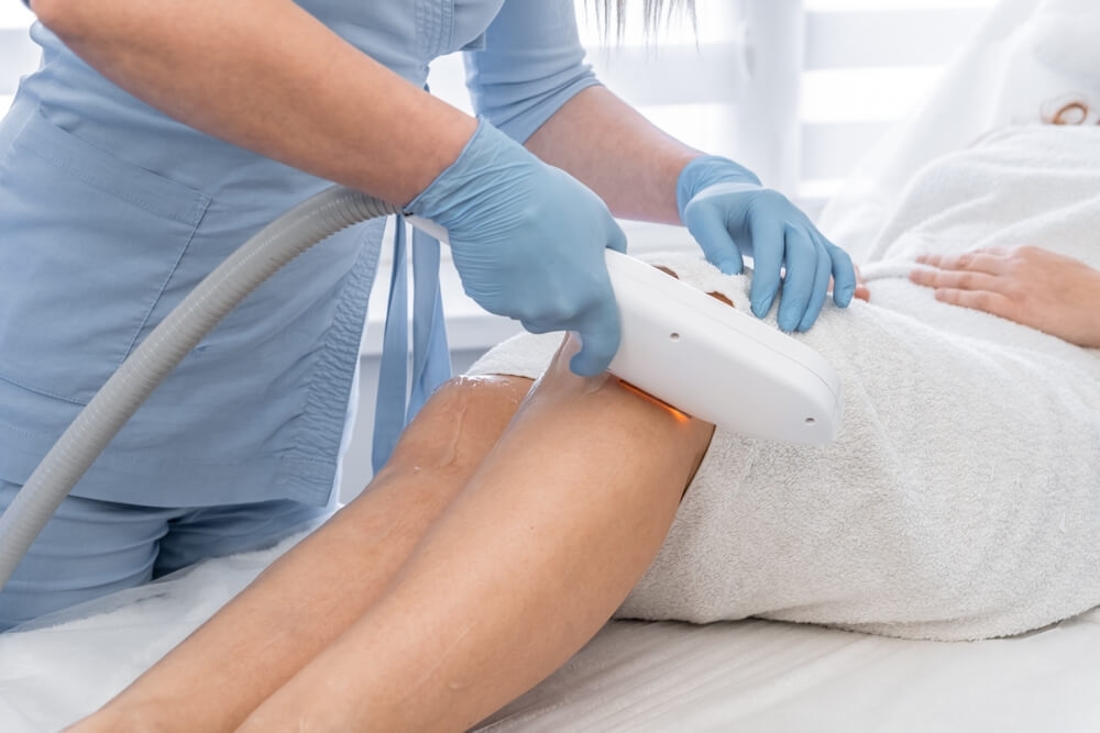 L’épilation définitive – Des technologies adaptées