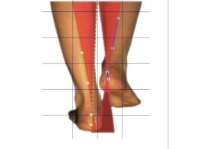 Analyse de la marche-course