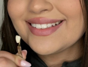 Blanchiment dentaire