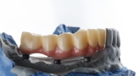 Artikel vu Dental Weber (Laboratoire Dentaire)