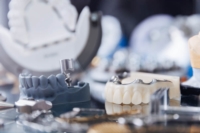 Artikel vu Dental Weber (Laboratoire Dentaire)