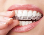 Article de Cabinet Grande Duchesse Charlotte | Orthodontie | Dudelange Luxembourg