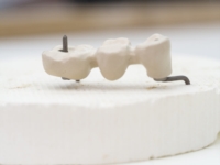 Artikel vonOptident Sàrl